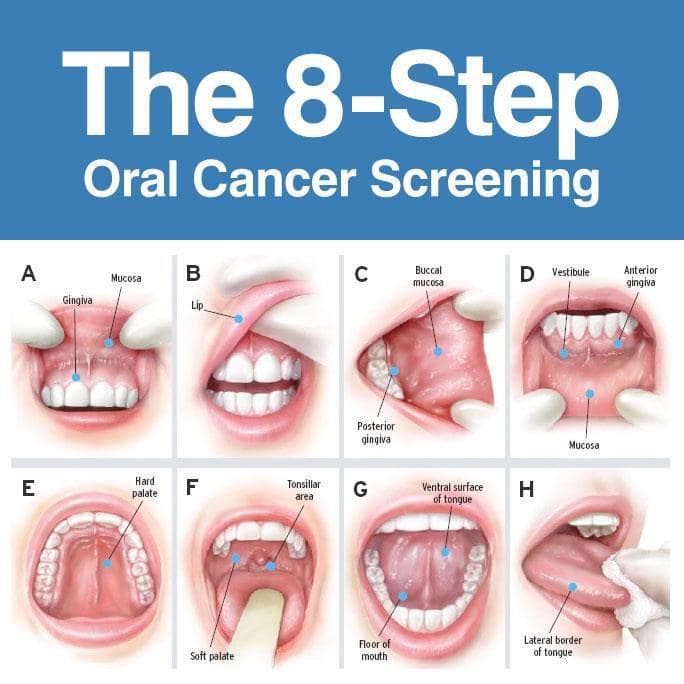 April Is Oral Cancer Awareness Month Bearable Dentistry